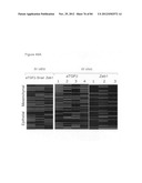 USE OF EMT GENE SIGNATURES IN CANCER DRUG DISCOVERY, DIAGNOSTICS, AND     TREATMENT diagram and image