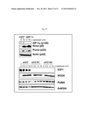 BIOMARKERS FOR GOSSYPOL CHEMOTHERAPY AND METHODS OF TREATING DISEASE diagram and image