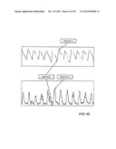 SYSTEM AND METHOD FOR SPO2 INSTABILITY DETECTION AND QUANTIFICATION diagram and image