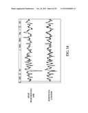 DISTRIBUTED, MINIMALLY-INVASIVE NEURAL INTERFACE FOR WIRELESS EPIDURAL     RECORDING diagram and image