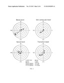 SYSTEM TO QUANTIFY AND VISUALIZE VENTRICULAR ROTATION PATTERN OF THE HEART diagram and image