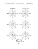 SYSTEM TO QUANTIFY AND VISUALIZE VENTRICULAR ROTATION PATTERN OF THE HEART diagram and image