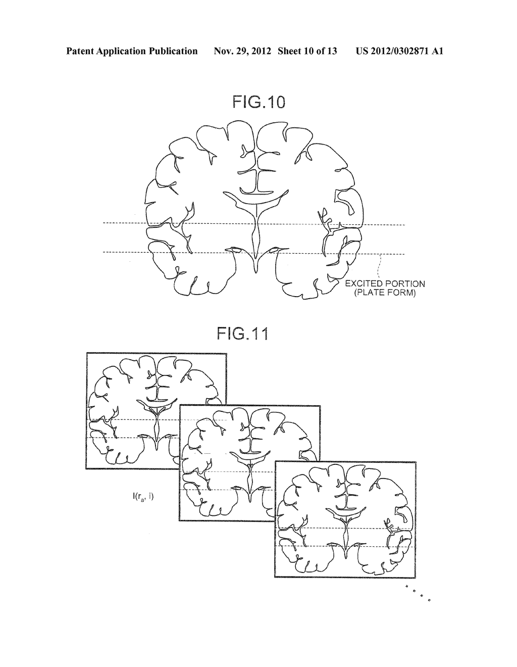 DETERMINING VELOCITY OF CEREBROSPINAL FLUID BY MAGNETIC RESONANCE IMAGING - diagram, schematic, and image 11