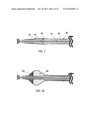 CATHETER MOUNTED AUTOMATIC VESSEL OCCLUSION AND FLUID DISPERSION DEVICES diagram and image