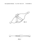 CATHETER MOUNTED AUTOMATIC VESSEL OCCLUSION AND FLUID DISPERSION DEVICES diagram and image