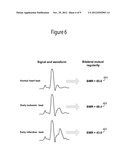 System for Cardiac Impairment Detection Based on Signal Regularity diagram and image