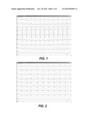 METHOD, APPARATUS AND COMPUTER PROGRAM PRODUCT FOR MONITORING     PHYSIOLOGICAL SIGNALS diagram and image