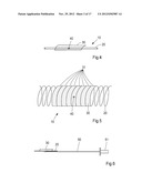 Device, Kit And Method For Closure Of A Body Lumen Puncture diagram and image