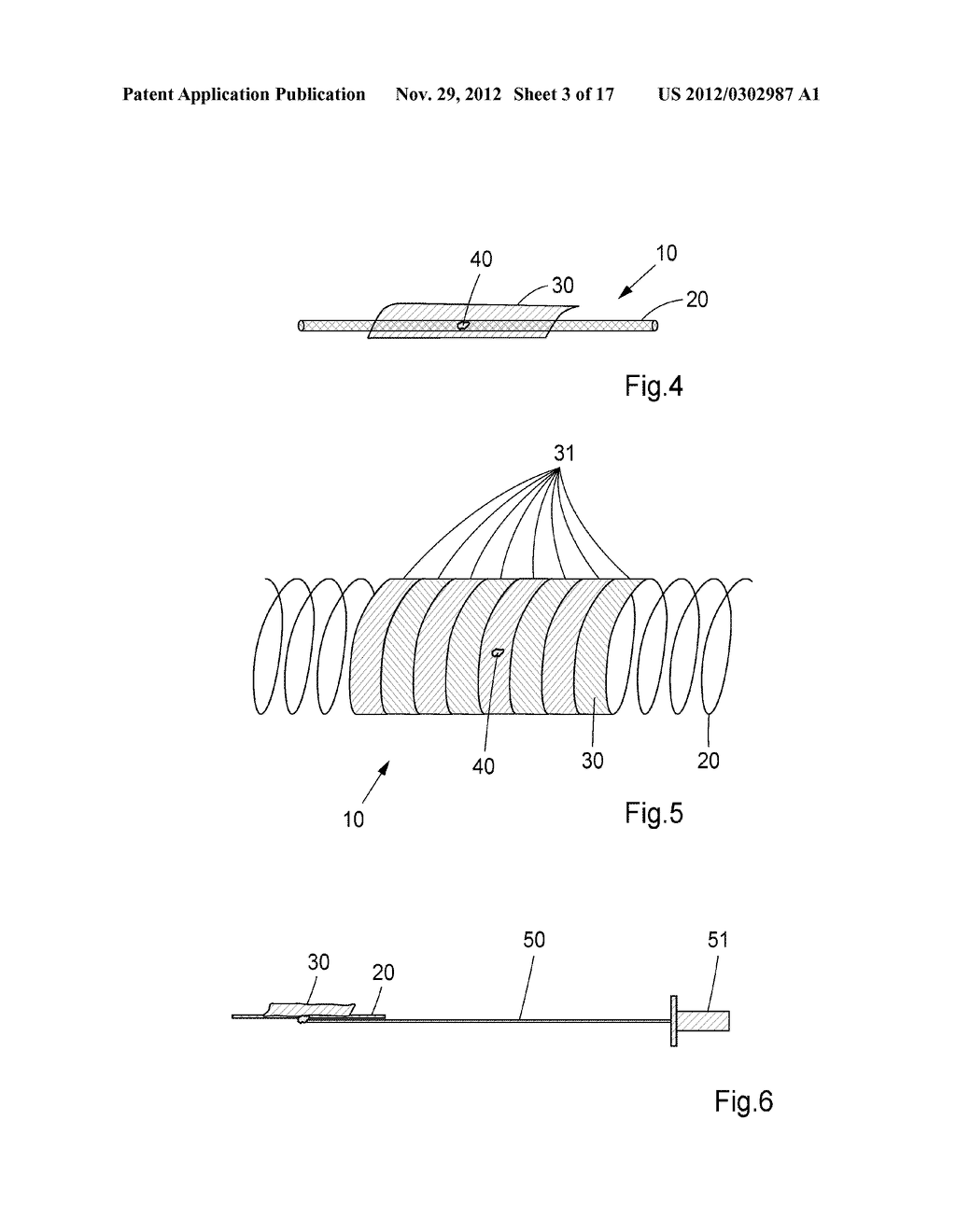 Device, Kit And Method For Closure Of A Body Lumen Puncture - diagram, schematic, and image 04