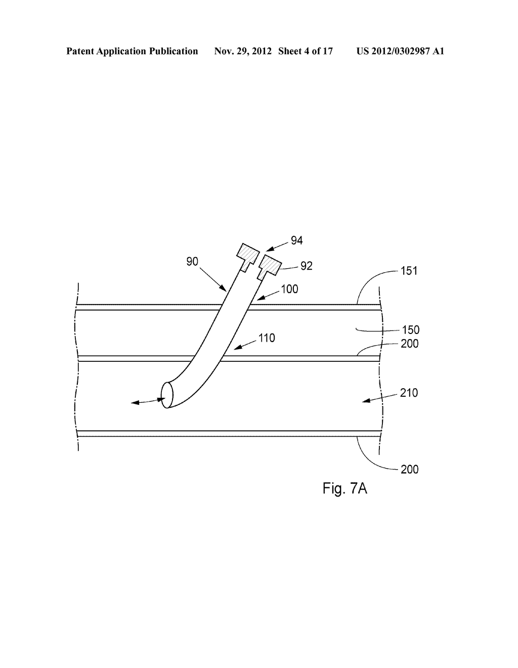 Device, Kit And Method For Closure Of A Body Lumen Puncture - diagram, schematic, and image 05
