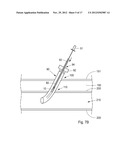 Device, Kit And Method For Closure Of A Body Lumen Puncture diagram and image