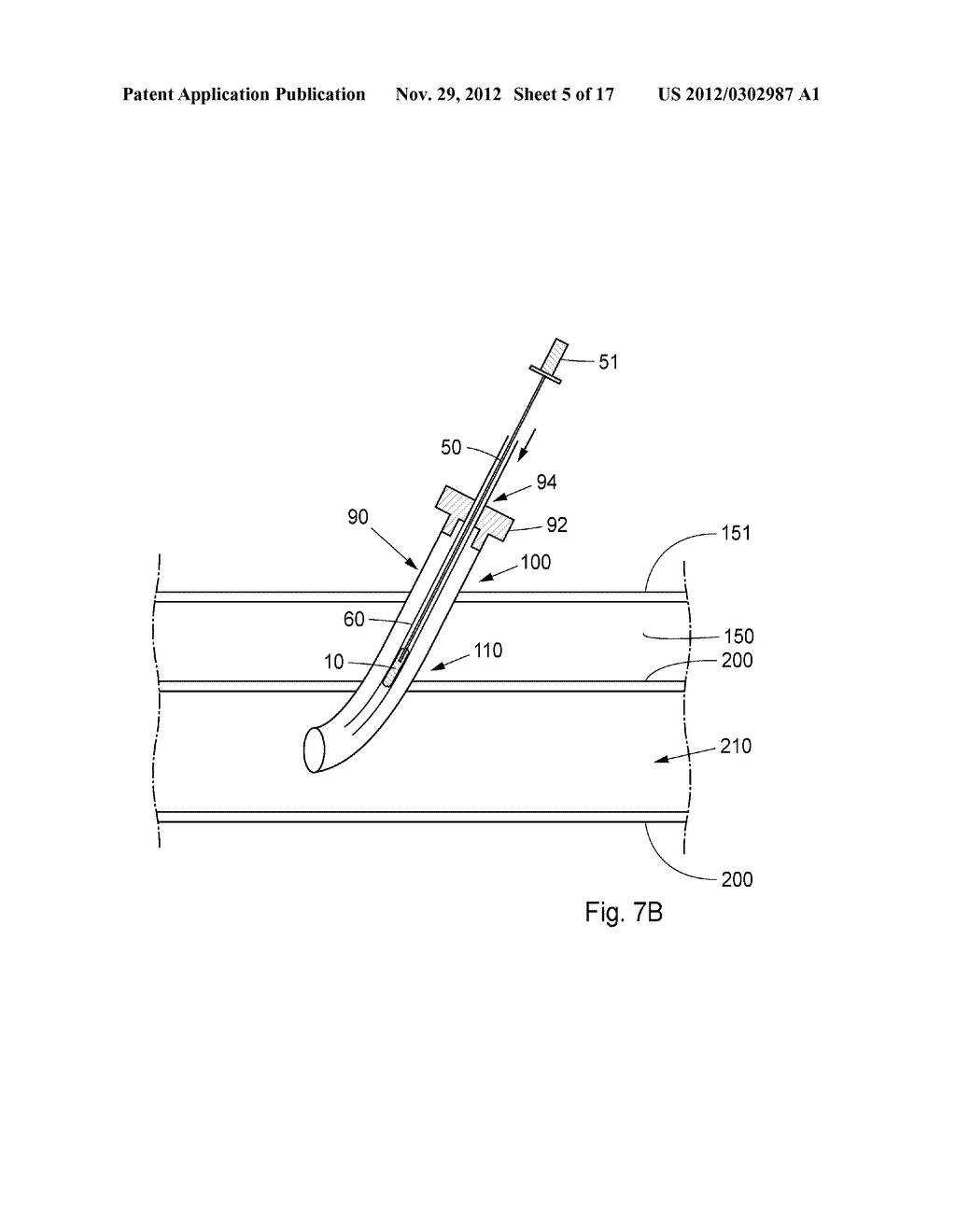 Device, Kit And Method For Closure Of A Body Lumen Puncture - diagram, schematic, and image 06