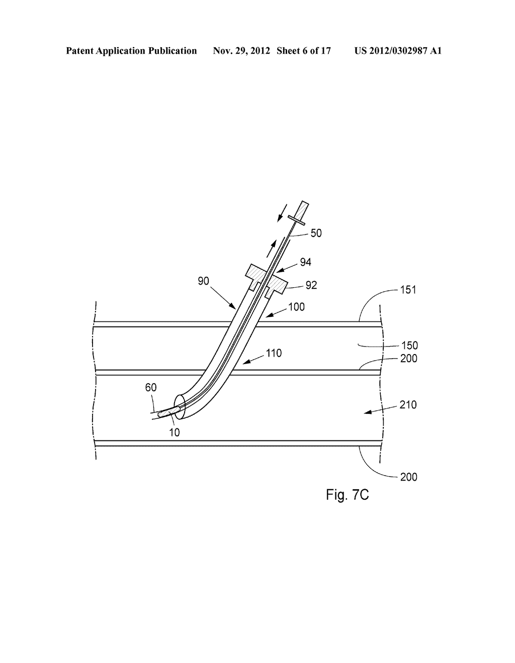 Device, Kit And Method For Closure Of A Body Lumen Puncture - diagram, schematic, and image 07