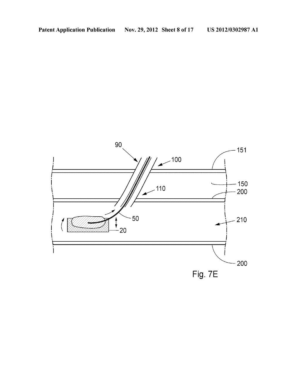 Device, Kit And Method For Closure Of A Body Lumen Puncture - diagram, schematic, and image 09