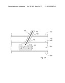 Device, Kit And Method For Closure Of A Body Lumen Puncture diagram and image