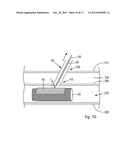 Device, Kit And Method For Closure Of A Body Lumen Puncture diagram and image