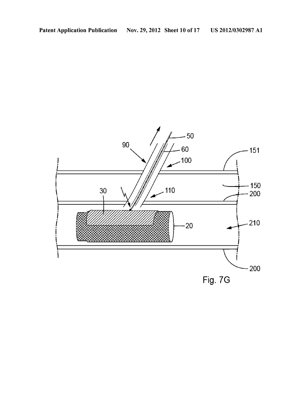 Device, Kit And Method For Closure Of A Body Lumen Puncture - diagram, schematic, and image 11