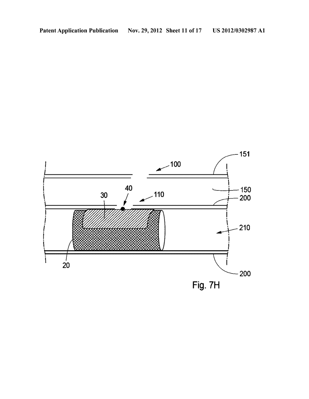 Device, Kit And Method For Closure Of A Body Lumen Puncture - diagram, schematic, and image 12