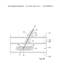 Device, Kit And Method For Closure Of A Body Lumen Puncture diagram and image