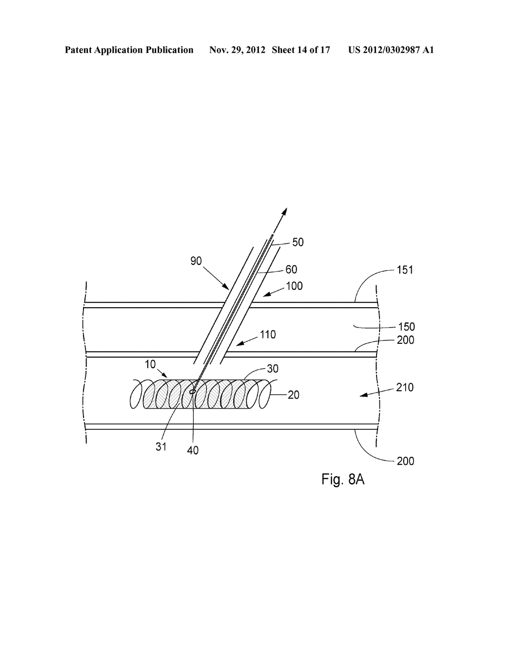 Device, Kit And Method For Closure Of A Body Lumen Puncture - diagram, schematic, and image 15