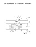 Device, Kit And Method For Closure Of A Body Lumen Puncture diagram and image