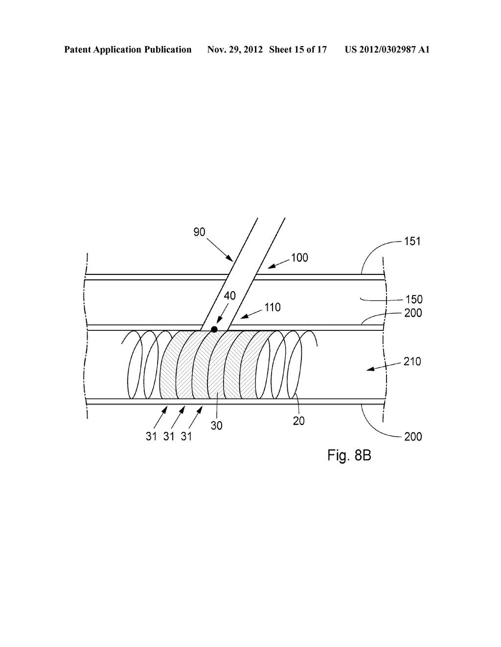 Device, Kit And Method For Closure Of A Body Lumen Puncture - diagram, schematic, and image 16