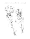 SURGICAL INSTRUMENT diagram and image