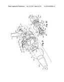 SURGICAL INSTRUMENT diagram and image