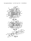 SURGICAL INSTRUMENT diagram and image