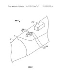 THERMAL PENETRATION AND ARC LENGTH CONTROLLABLE ELECTROSURGICAL PENCIL diagram and image