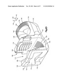 MINIMALLY INVASIVE SPINAL FIXATION SYSTEM INCLUDING VERTEBRAL ALIGNMENT     FEATURES diagram and image