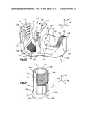 MINIMALLY INVASIVE SPINAL FIXATION SYSTEM INCLUDING VERTEBRAL ALIGNMENT     FEATURES diagram and image