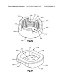 MINIMALLY INVASIVE SPINAL FIXATION SYSTEM INCLUDING VERTEBRAL ALIGNMENT     FEATURES diagram and image