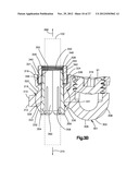 MINIMALLY INVASIVE SPINAL FIXATION SYSTEM INCLUDING VERTEBRAL ALIGNMENT     FEATURES diagram and image