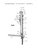 MINIMALLY INVASIVE SPINAL FIXATION SYSTEM INCLUDING VERTEBRAL ALIGNMENT     FEATURES diagram and image