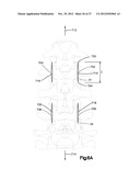 MINIMALLY INVASIVE SPINAL FIXATION SYSTEM INCLUDING VERTEBRAL ALIGNMENT     FEATURES diagram and image