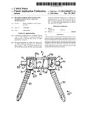 Dynamic stabilization connecting member with elastic core and outer sleeve diagram and image