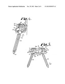 Dynamic stabilization connecting member with elastic core and outer sleeve diagram and image