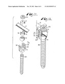 Dynamic stabilization connecting member with elastic core and outer sleeve diagram and image