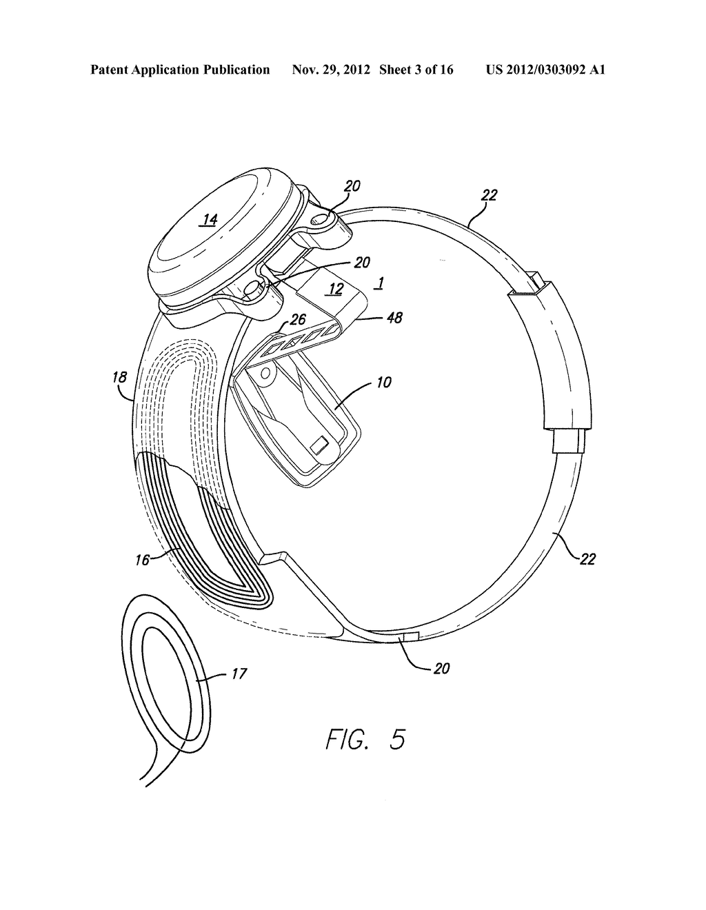 Method and Apparatus for Predicting and Controlling the Percepts Induced     by a Visual Prosthesis - diagram, schematic, and image 04