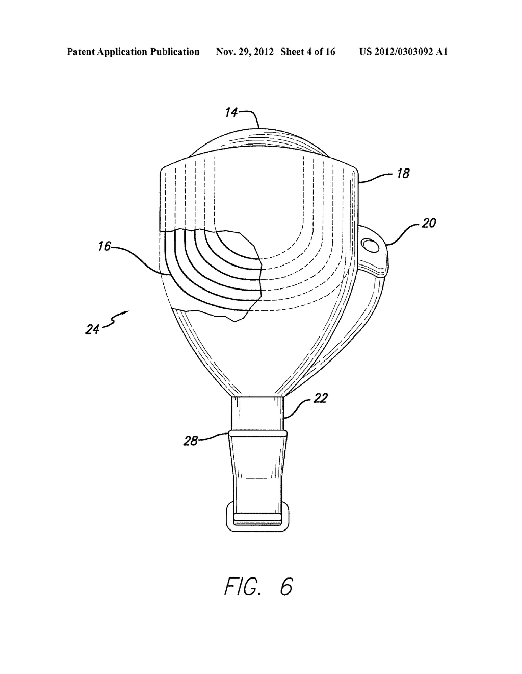 Method and Apparatus for Predicting and Controlling the Percepts Induced     by a Visual Prosthesis - diagram, schematic, and image 05