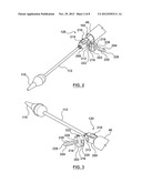 Attachment Mechanism for Stent Release diagram and image