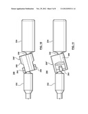 Attachment Mechanism for Stent Release diagram and image