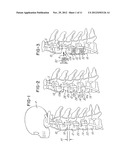 FUSION SYSTEM AND METHOD FOR FUSING SPINAL BONES diagram and image