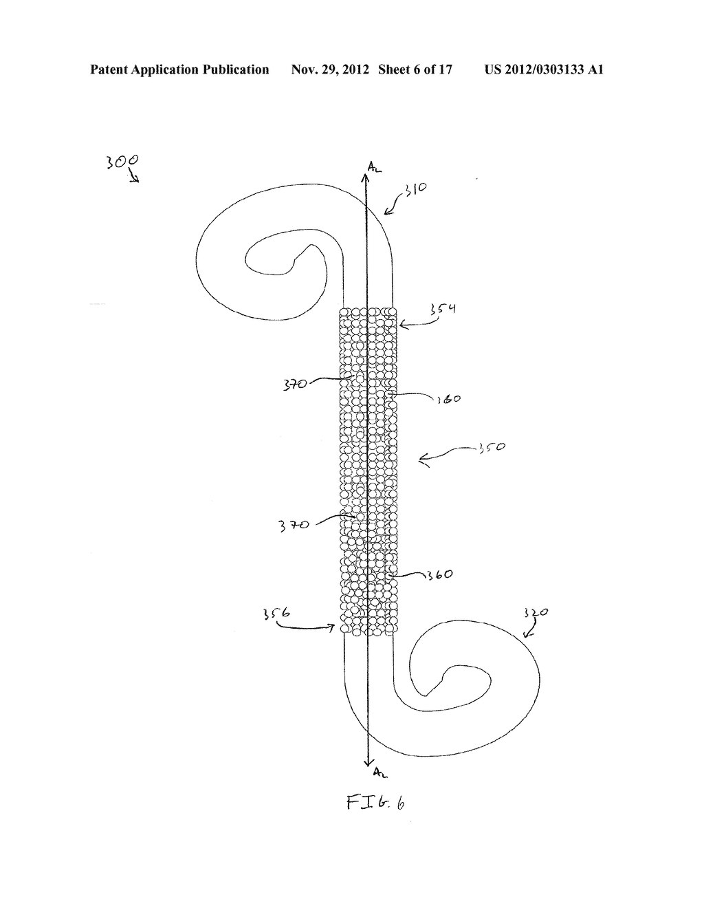 POROUS URETERAL STENT - diagram, schematic, and image 07