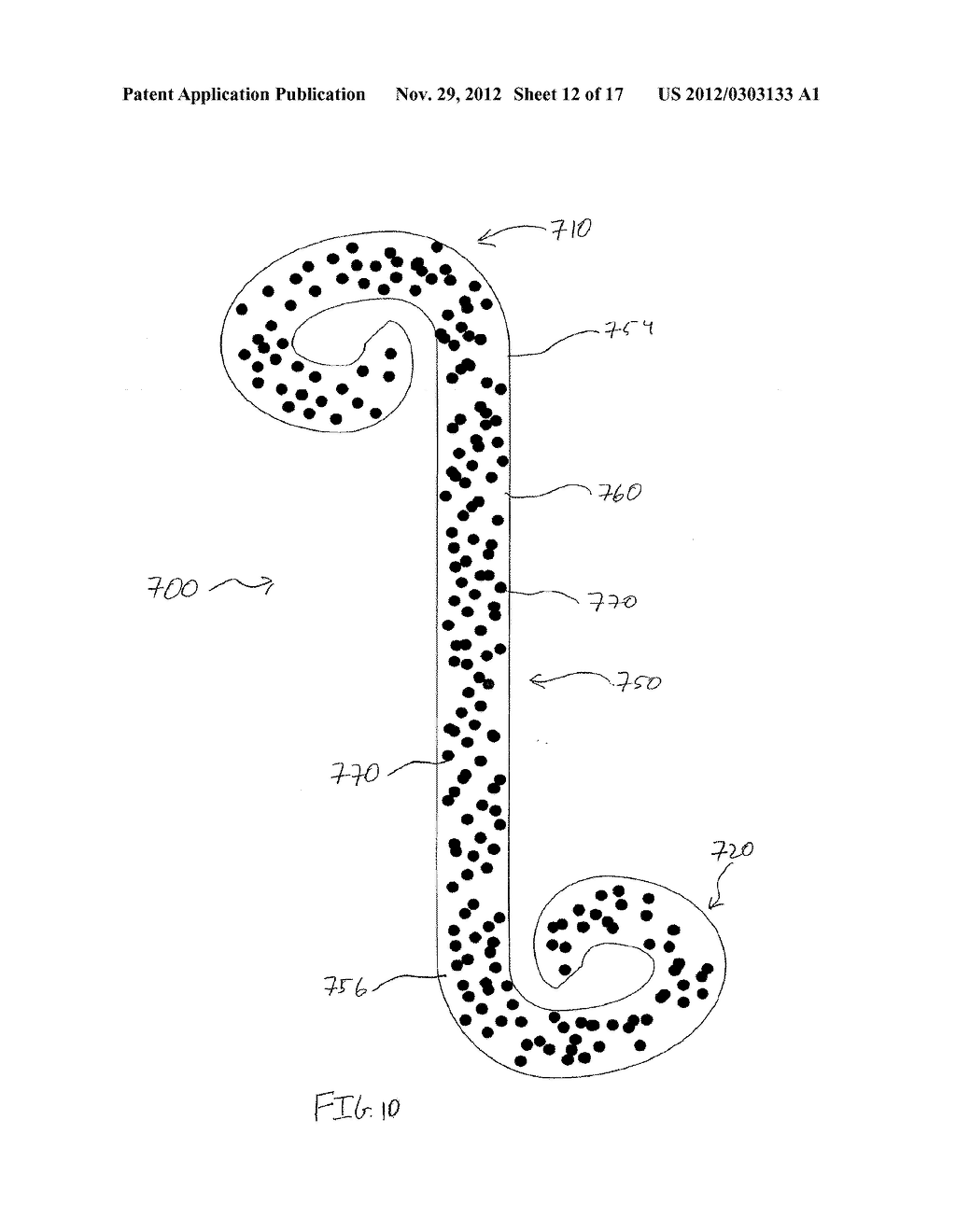 POROUS URETERAL STENT - diagram, schematic, and image 13