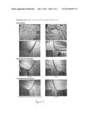 UNDERARM STAIN REMOVER COMPOSITION diagram and image