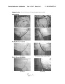 UNDERARM STAIN REMOVER COMPOSITION diagram and image