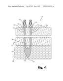 FORMING ORIENTED FISSURES IN A SUBTERRANEAN TARGET ZONE diagram and image