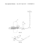 HOOD LATCH AND STRIKER SYSTEM FOR PEDESTRIAN PROTECTION diagram and image